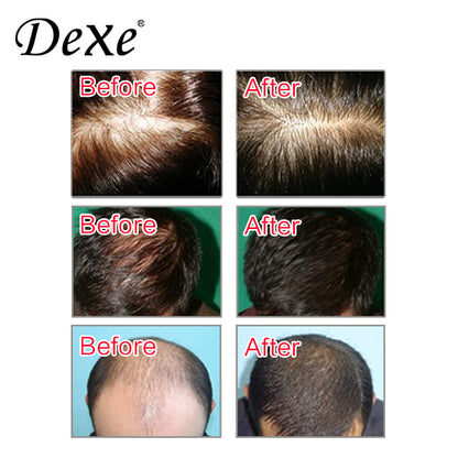 Dexe Anti Hair Loss Shampoo